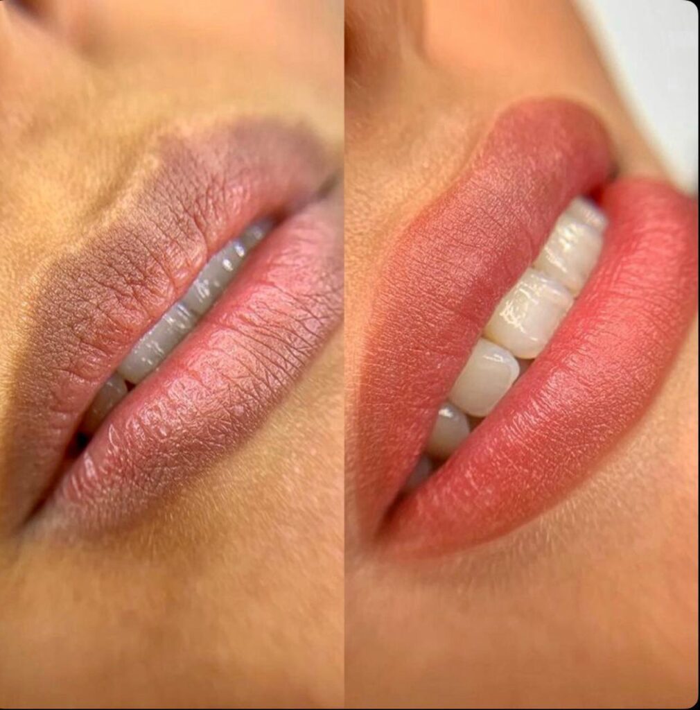 Bibir sebelum dan sesudah sulam bibir, warnanya lebih merata