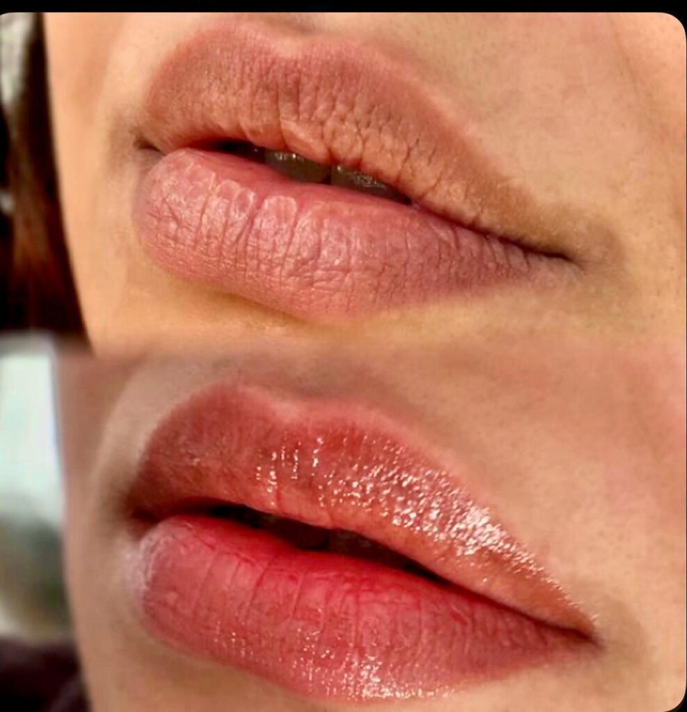 Bibir sebelum dan sesudah sulam bibir